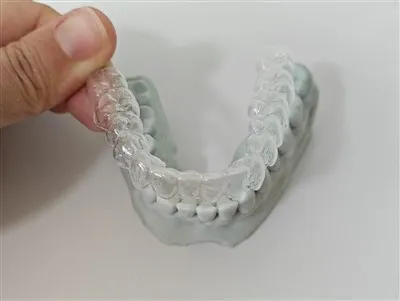 Ako funguje priehľadný retainer?