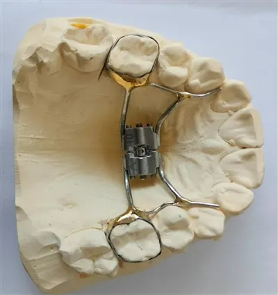 Existujú nejaké výskumné štúdie o snímateľných protézach?